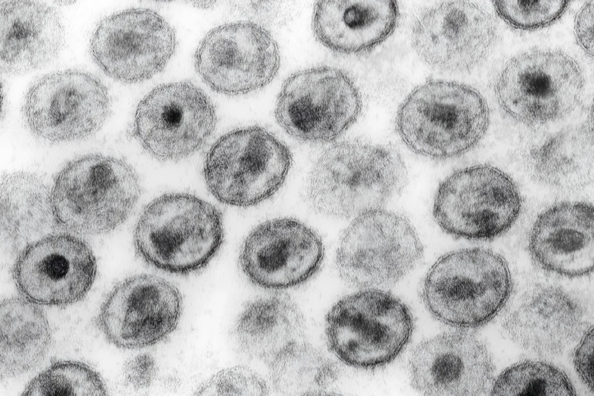 In Memoriam: Dr. Masayoshi Negishi, Pioneer of AIDS Treatment in Japan 13 Electron microscope image showing multiple HIV particles.